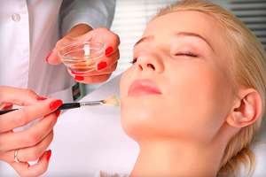 Пилинг от прыщей