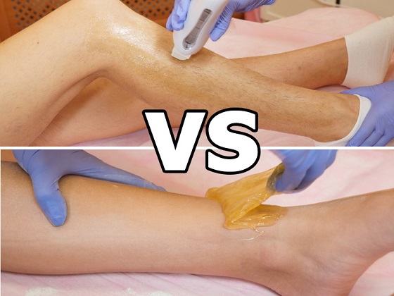 Шугаринг vs Воск. Как определится с выбором?