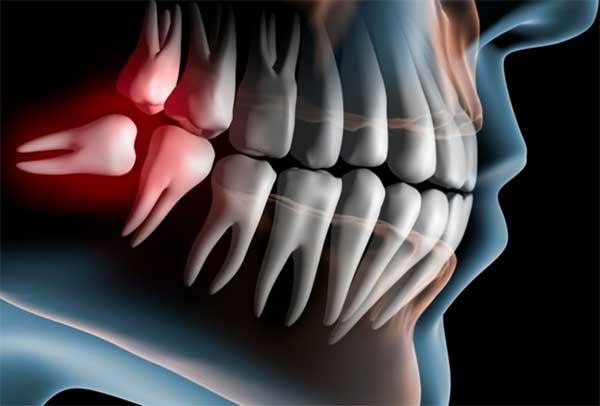 По какой причине хрустит челюсть и что делать?