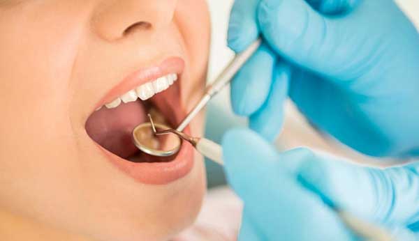 Лечение поверхностного кариеса: что нужно знать