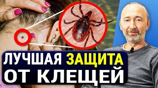 Как защитить себя от клещей? Попробуйте этот домашний способ