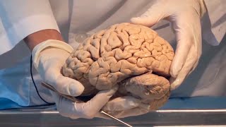 Ненависть в мозгу - как это работает?