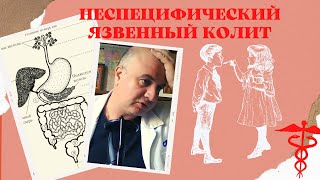 Внутрикишечные поражения при неспецифическом язвенном колите