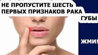 Рак губы: причины, симптомы и лечение