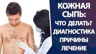 Что такое сыпь и может ли она быть симптомом венерического заболевания?