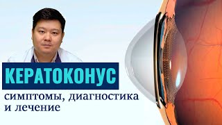 Что такое кератоконус?