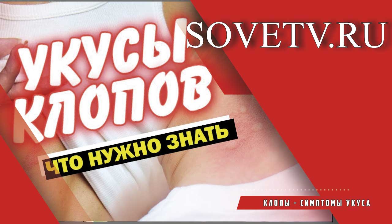 Клопы - симптомы укуса и борьба с клопами