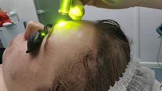 Лазерные технологии в уходе за кожей: секреты успешного результата