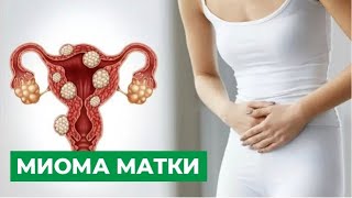 Лейомиома матки: основные причины, симптомы и эффективные методы лечения